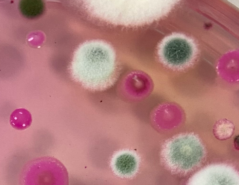 Close up of mould under a microscope